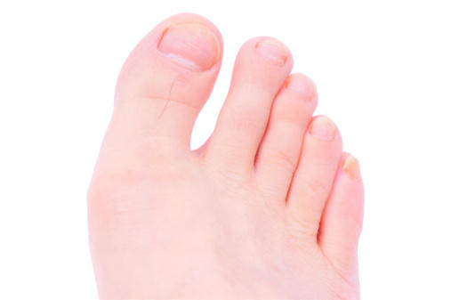 Nkpsi ụkwụ